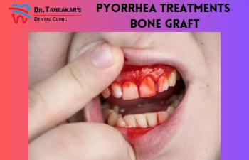 PYORRHEA TREATMENTS & BONE GRAFT