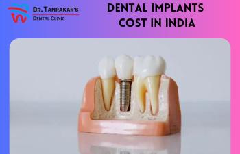 Dental Implants Cost In India