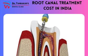 Root Canal Treatment Cost In India