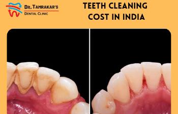 Dental Or Teeth Cleaning Cost In India
