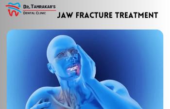 Jaw Fracture Treatment